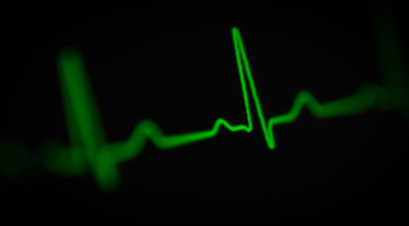 How to make HEART metrics work in practice