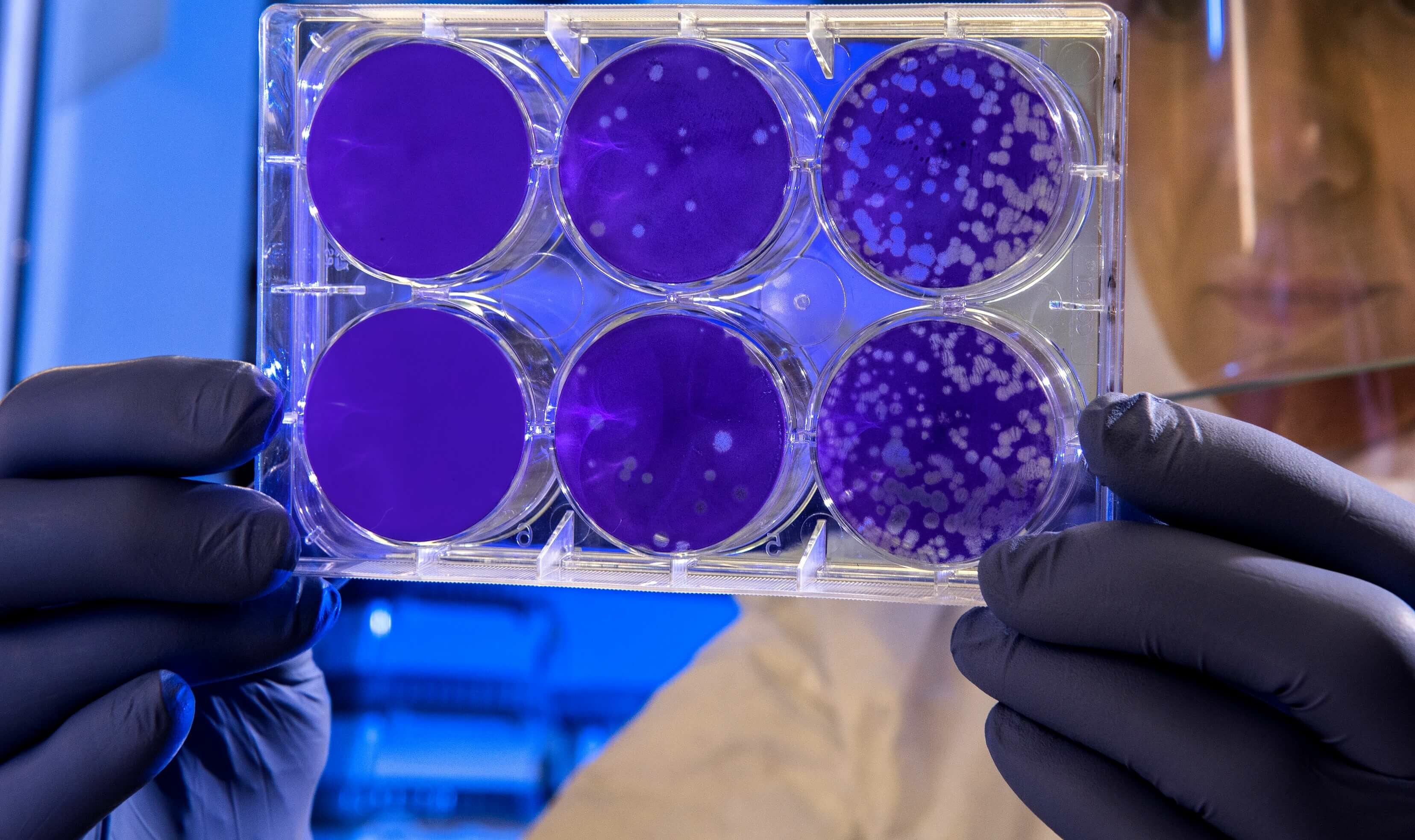 Machine Learning Application Growing in Life Science and Pharma