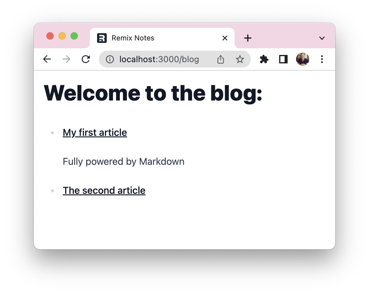 Remix Markdown overview