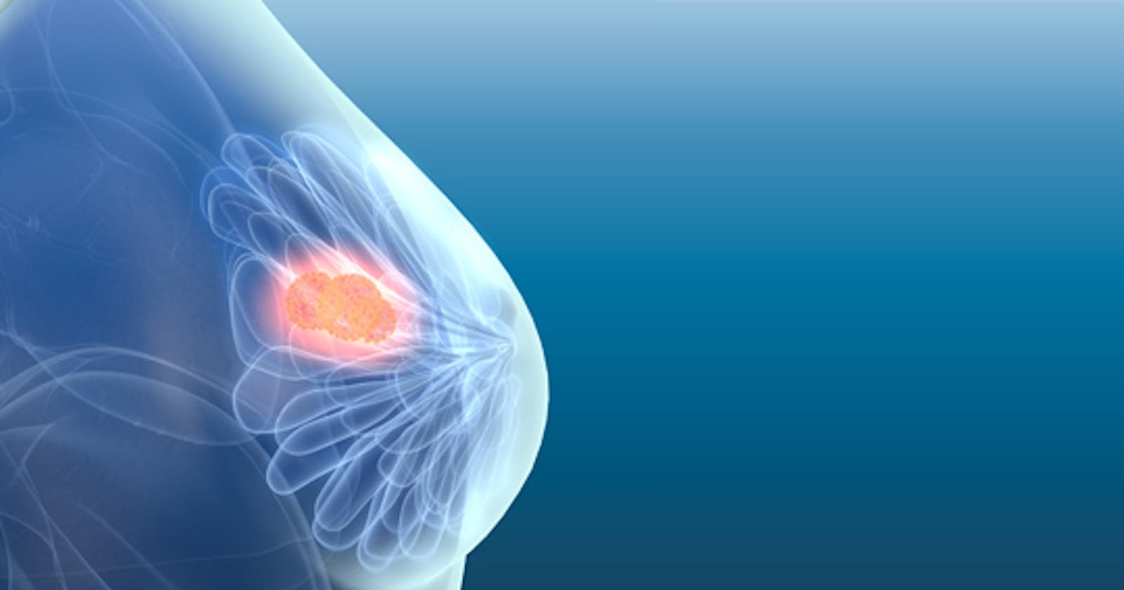 Machine Learning web-app to breast cancer diagnosis II