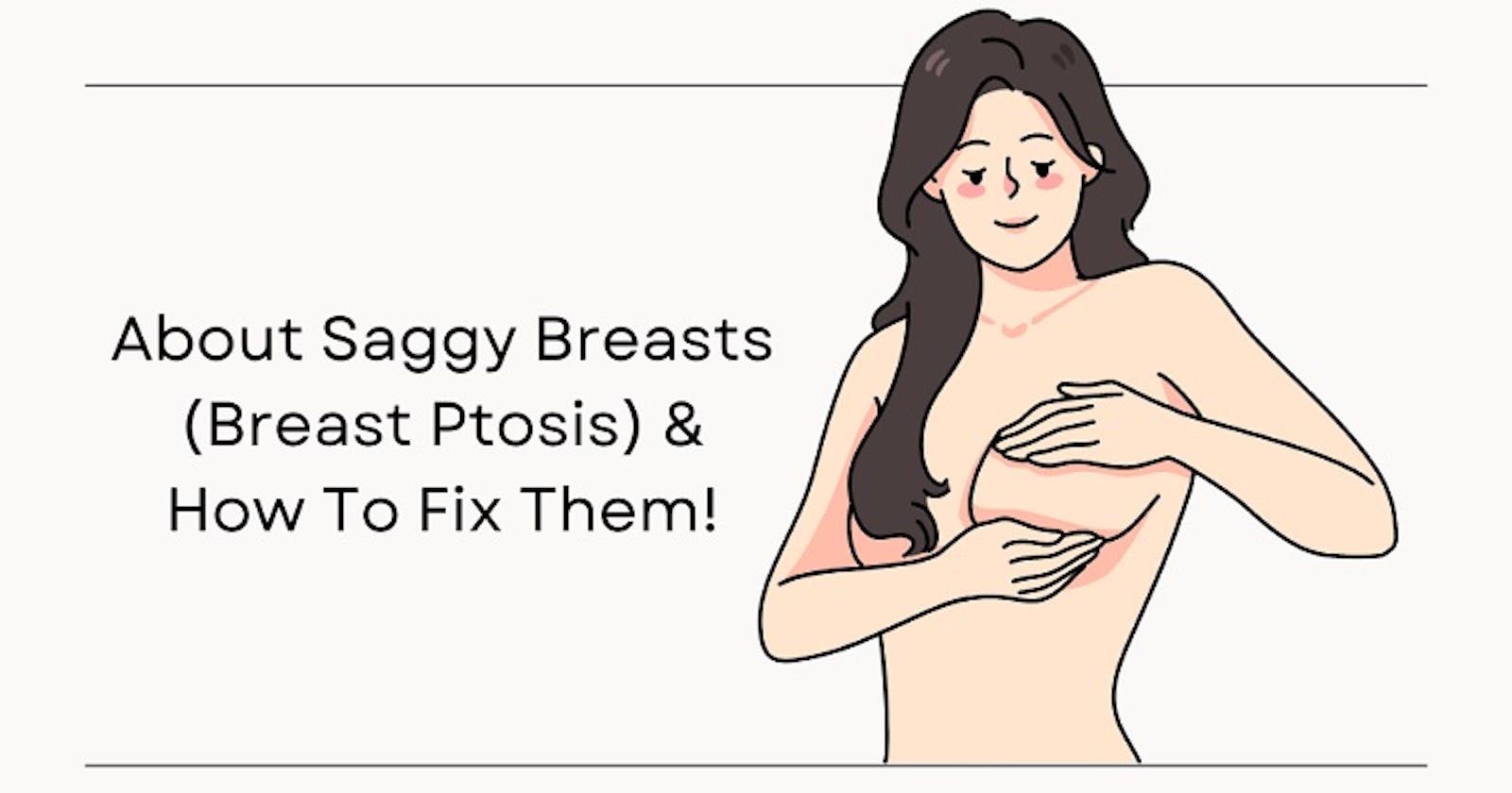 Breast ptosis, what is it and how to fix them?