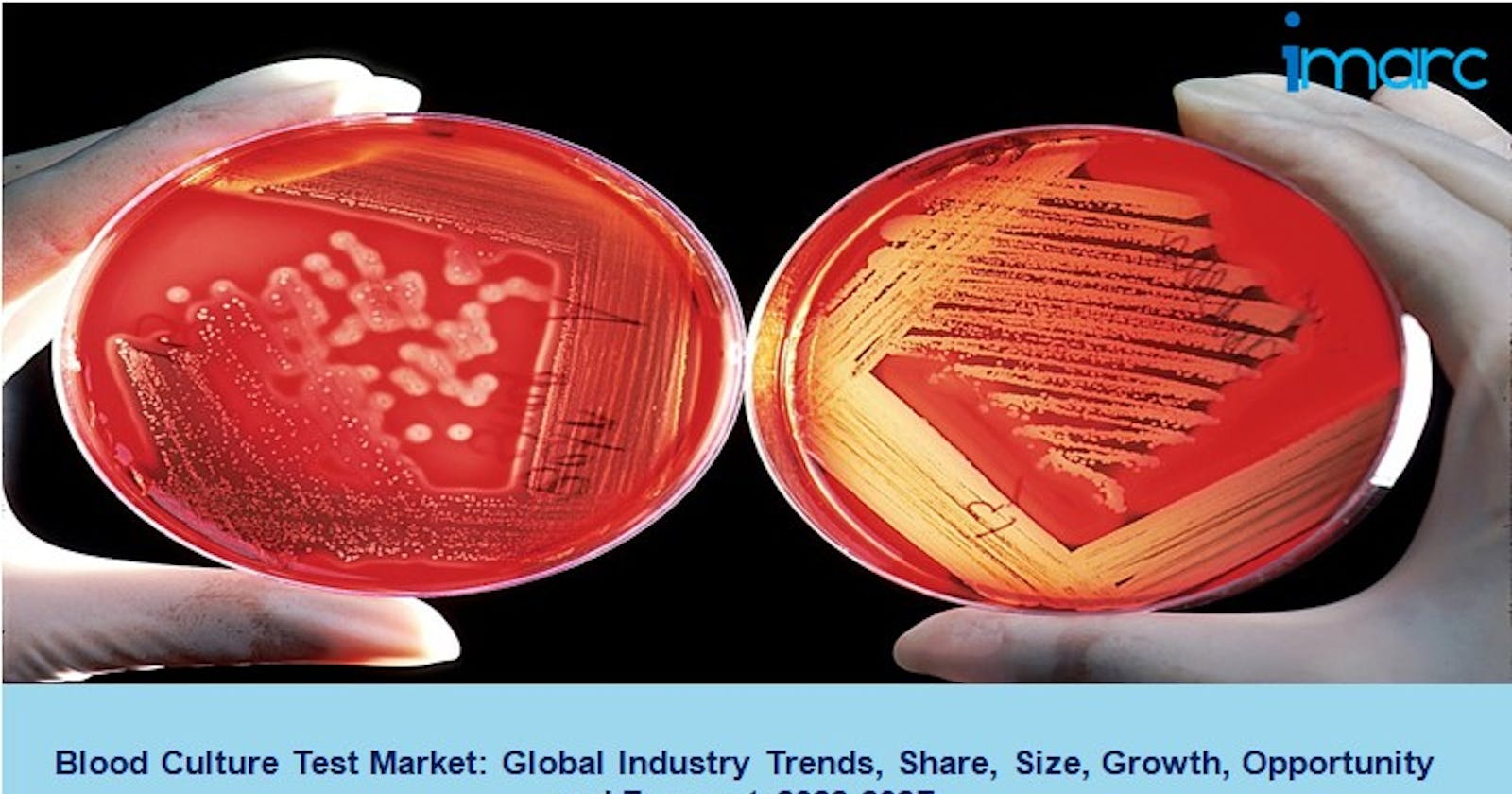 Blood Culture Test Market 2022, Share, Demand, Trends and Growth Report 2027