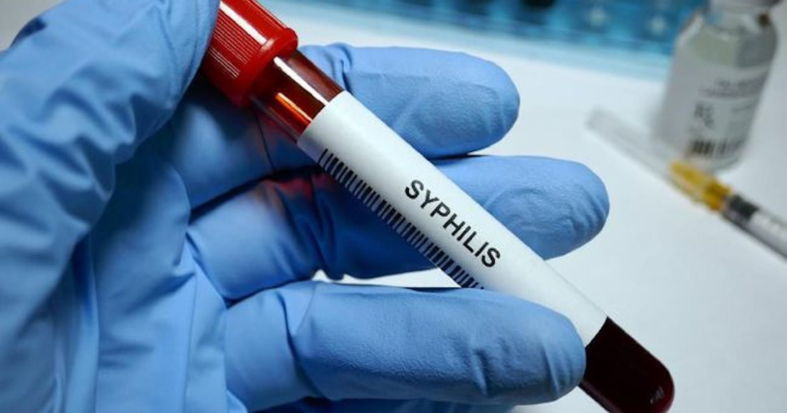 Pengobatan Sifilis di Klinik Kelamin Jakarta