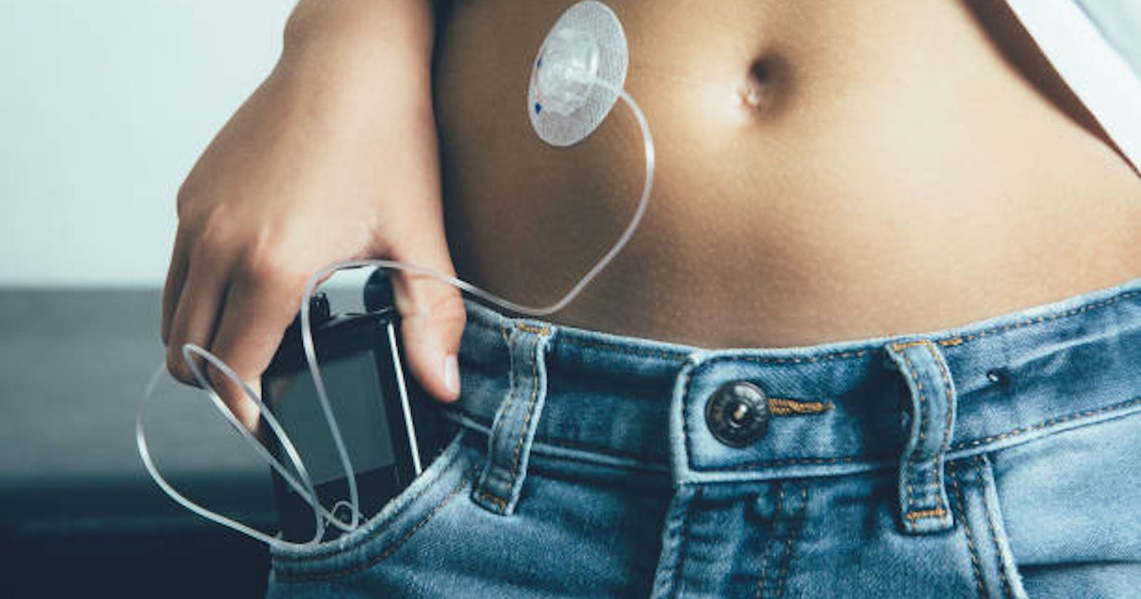 United States Insulin Pumps Market 2027: Overview, Analysis, Growth, Scope and Key Players