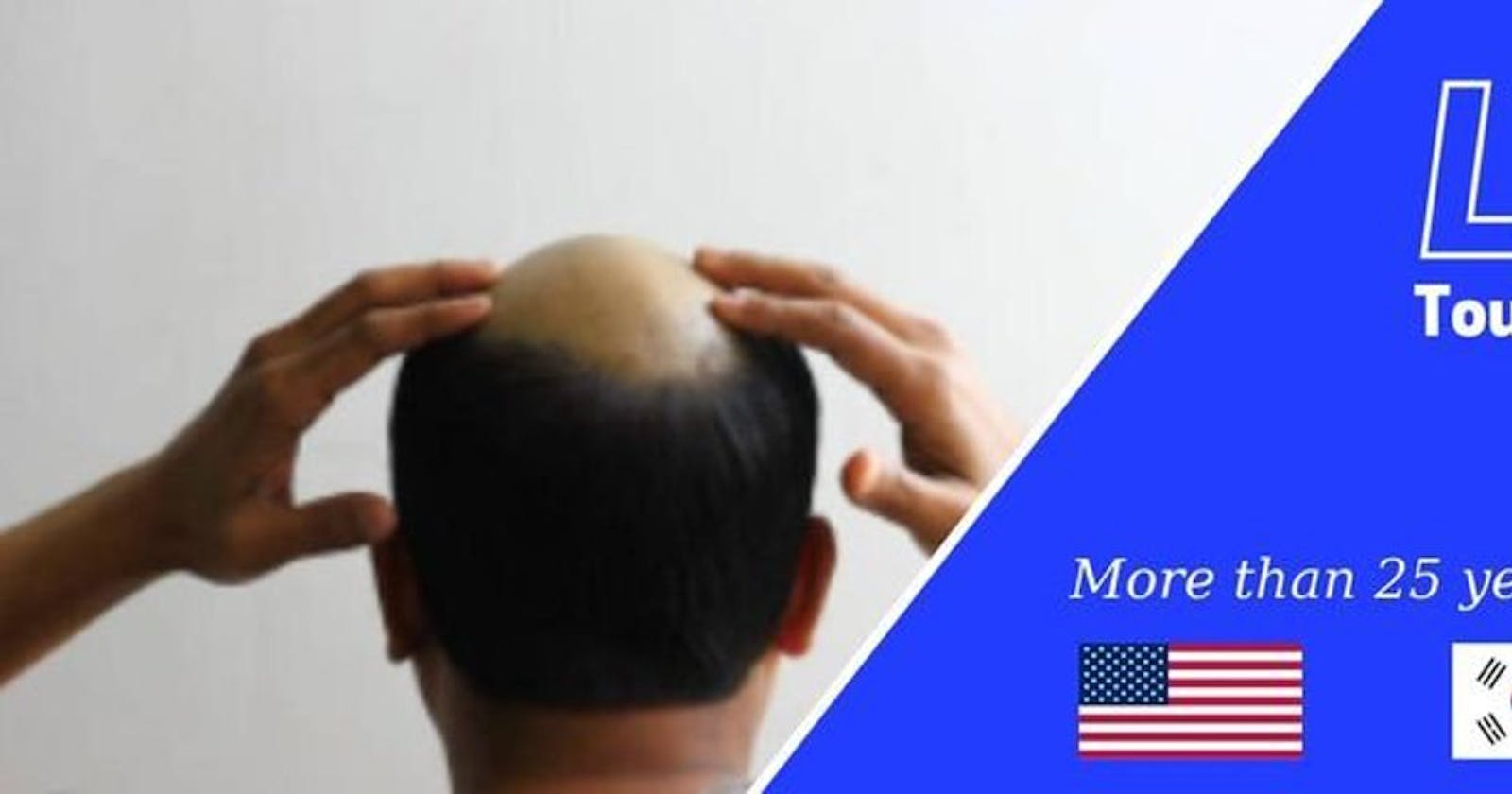 Phuc Thien Toupee - Leader Hair Replacement For Men Producer In Viet Nam