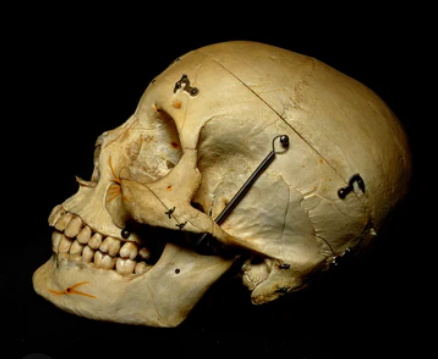 Real Human Skulls For sale