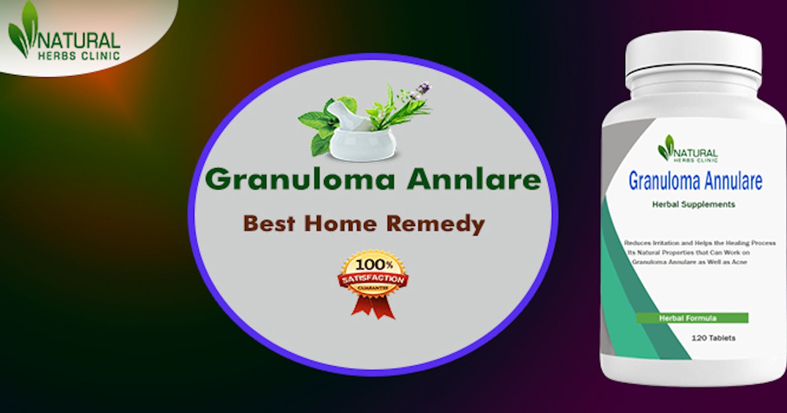 How to Get Rid of My Granuloma  Annulare Using Natural Remedies