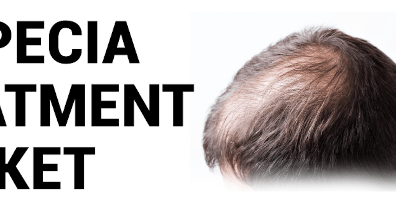 Alopecia Treatment Market 2023: Rising Awareness and Growing Demand for Effective Therapies