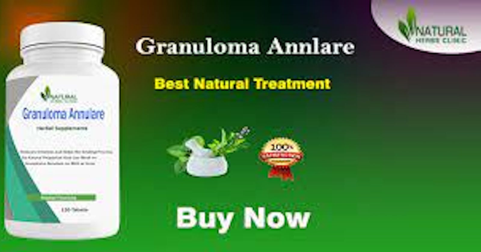 Symptoms and Causes of Granular skin diseases- Homeopathic Remedies offer hope