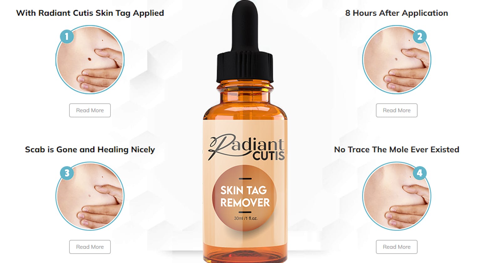Radiant Cutis Skin Tag Remover: The Safe and Easy Way to Remove Skin Tags!
