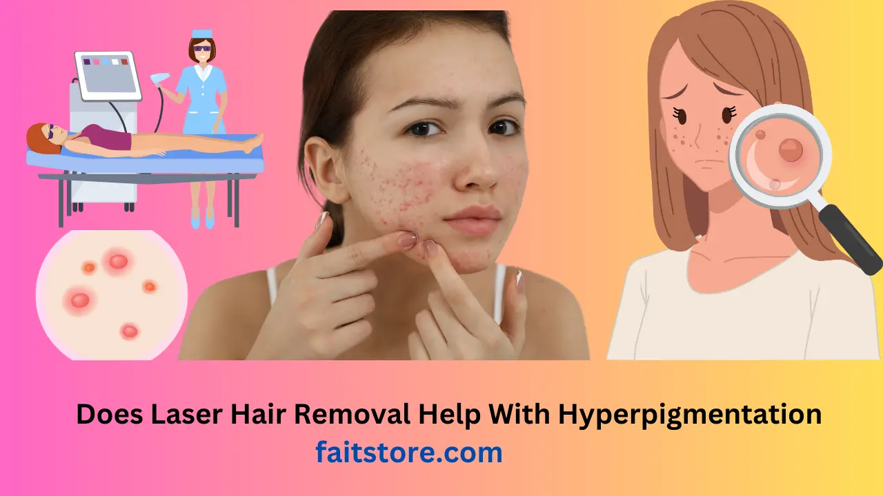 Does Laser Hair Removal Help with Hyperpigmentation