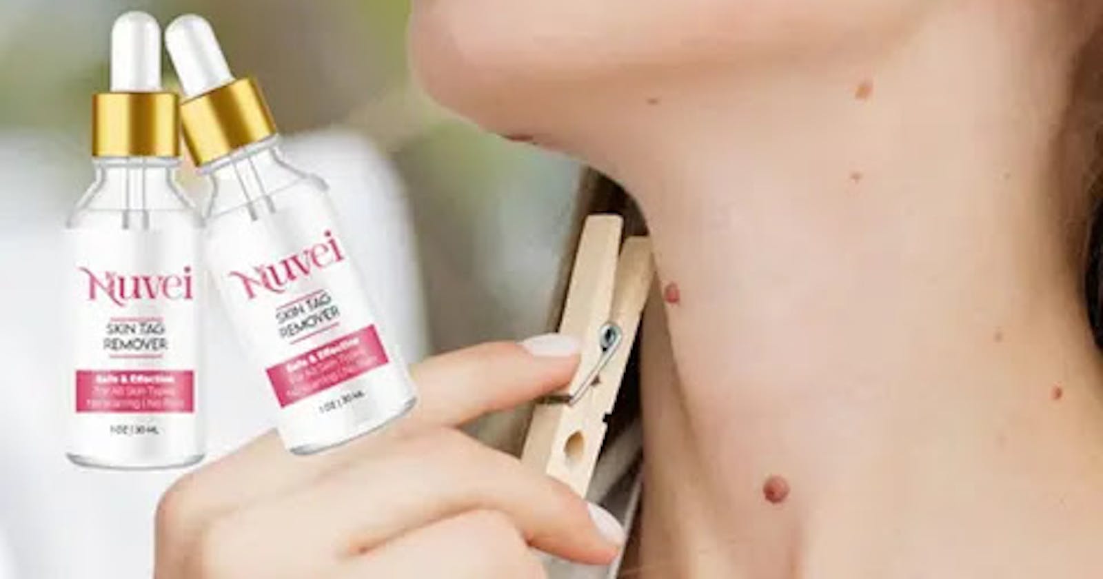 Nuvei Skin Tag Remover - Don't Buy Before Read Official Reviews!
