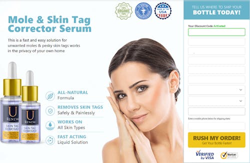 U Renew Skin Tag Remover's blog