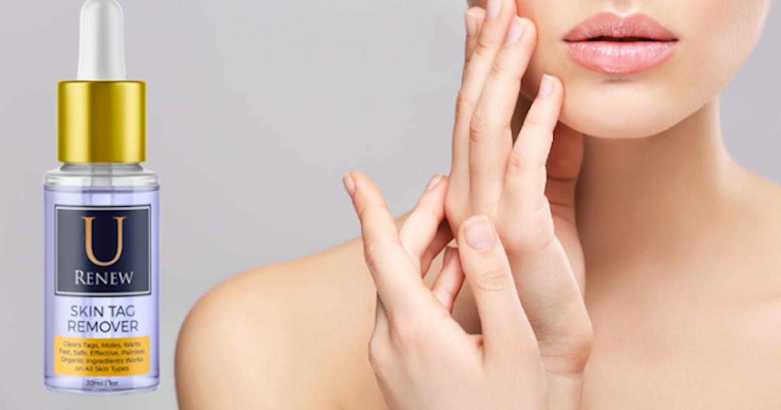U Renew Skin Tag Remover - (Fake Or Legit) What Real Customer Say? Read Shocking?