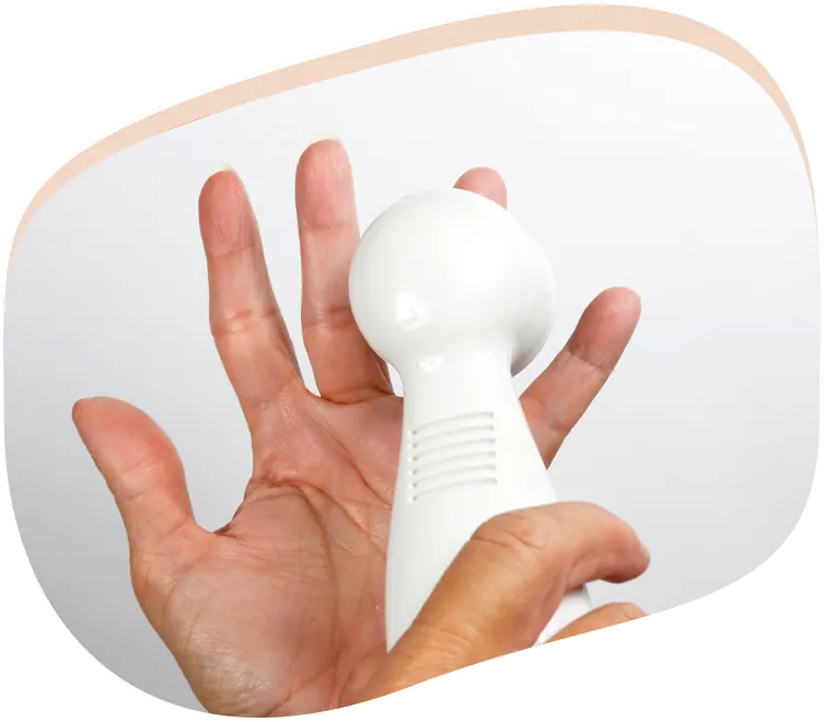 Splints: Empowering Hand Functionality in Dupuytren's Contracture