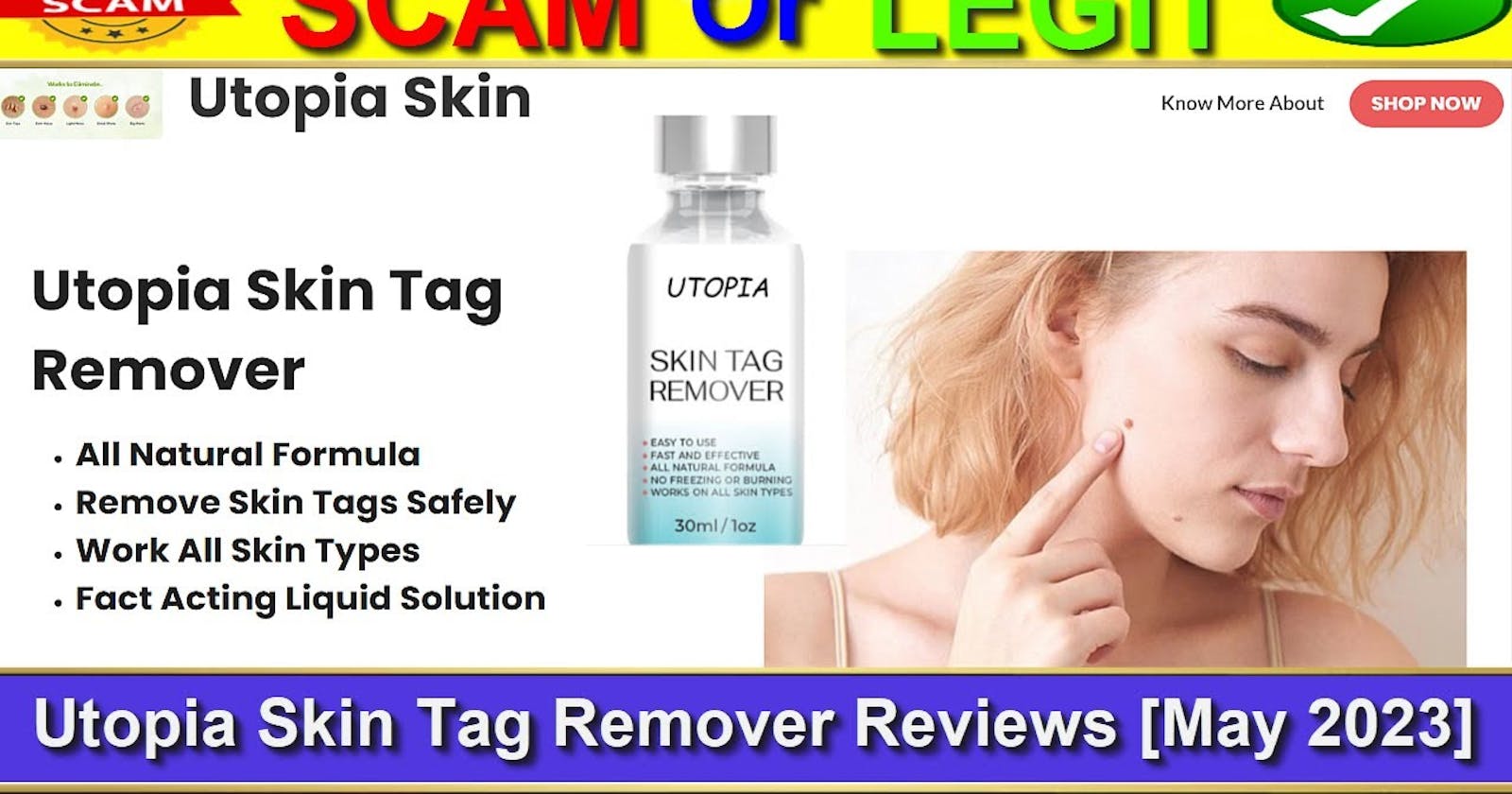 Utopia Skin Tag Remover : An Anti-Aging Formula For Wrinkle-Free Skin! Results, Where To Buy?