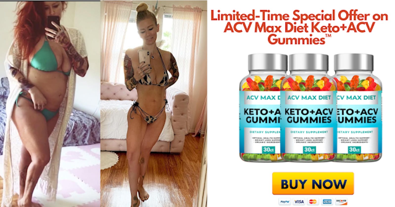 Xtreme Fit Keto ACV Gummies - 100% Legit Most Effective & Powerful CBD!