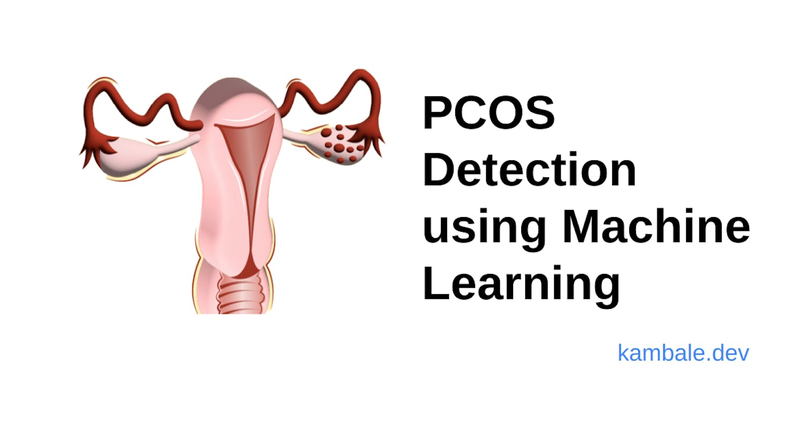 PCOS Detection Using Machine Learning