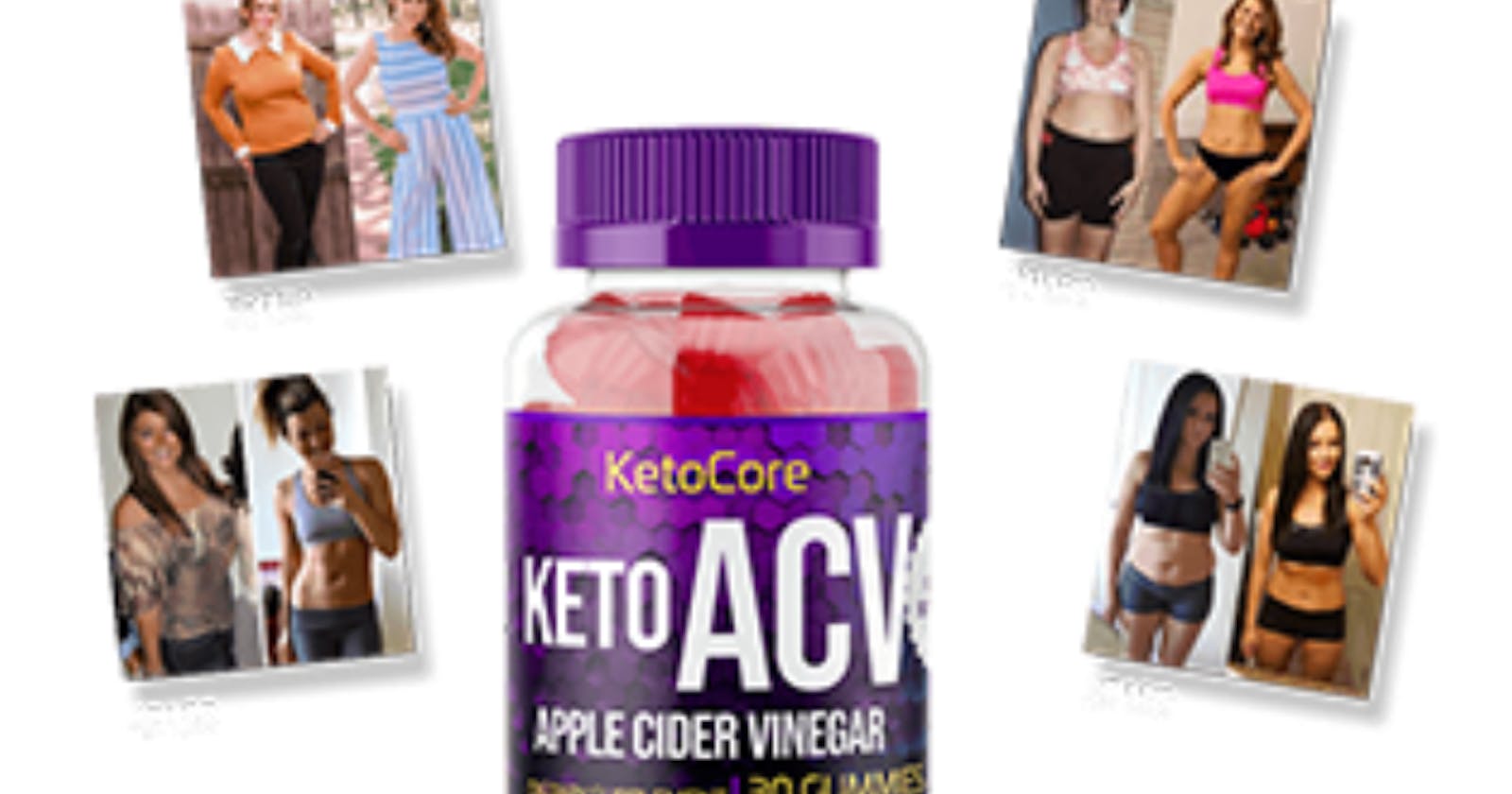 Keto Core ACV Gummies Canada Reviews - Safe Weight Loss Supplement or Weak Ingredients?