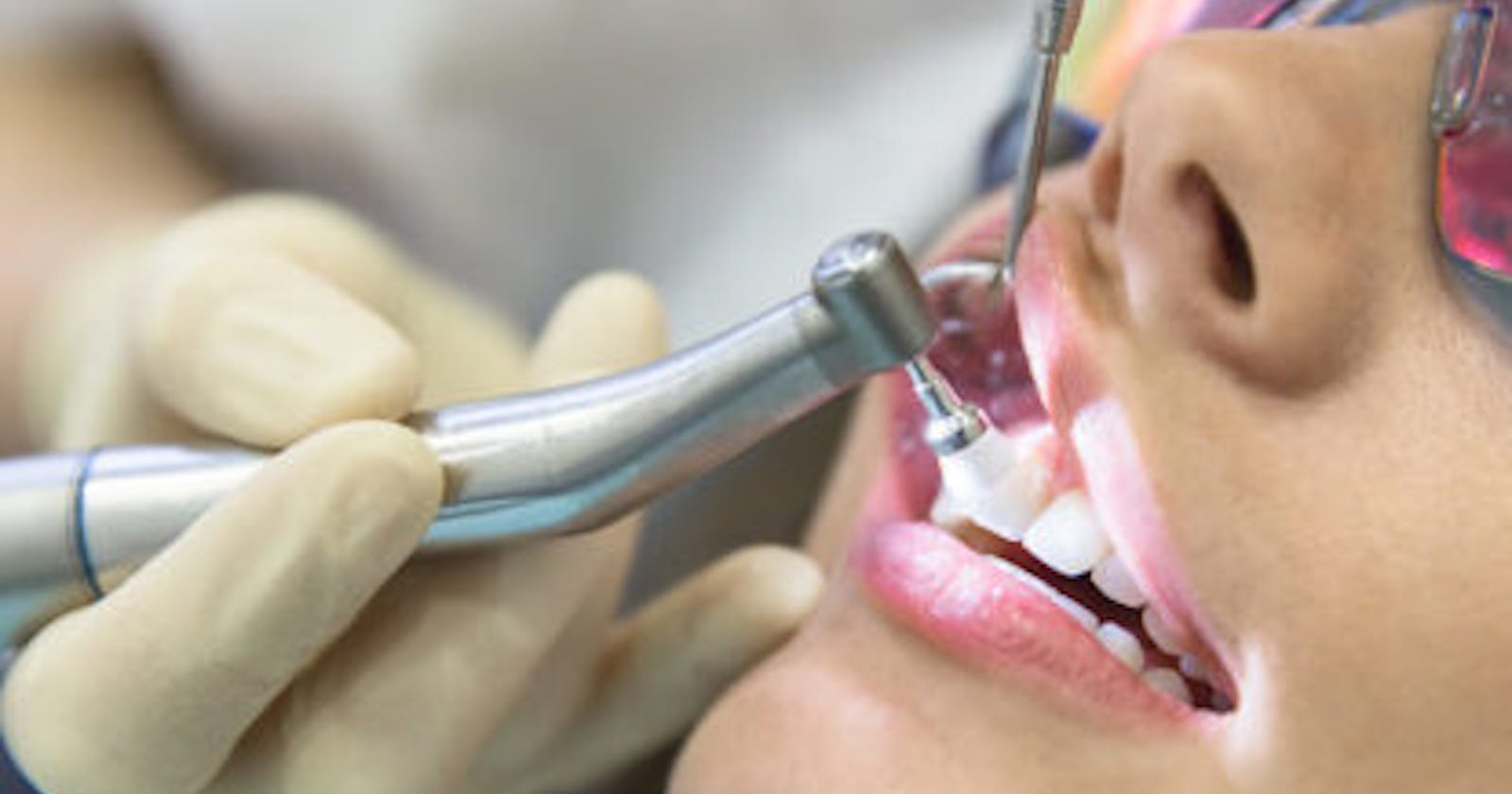 Tips Suggested By Dentist In Ranchi To Maintain Good Oral Heath