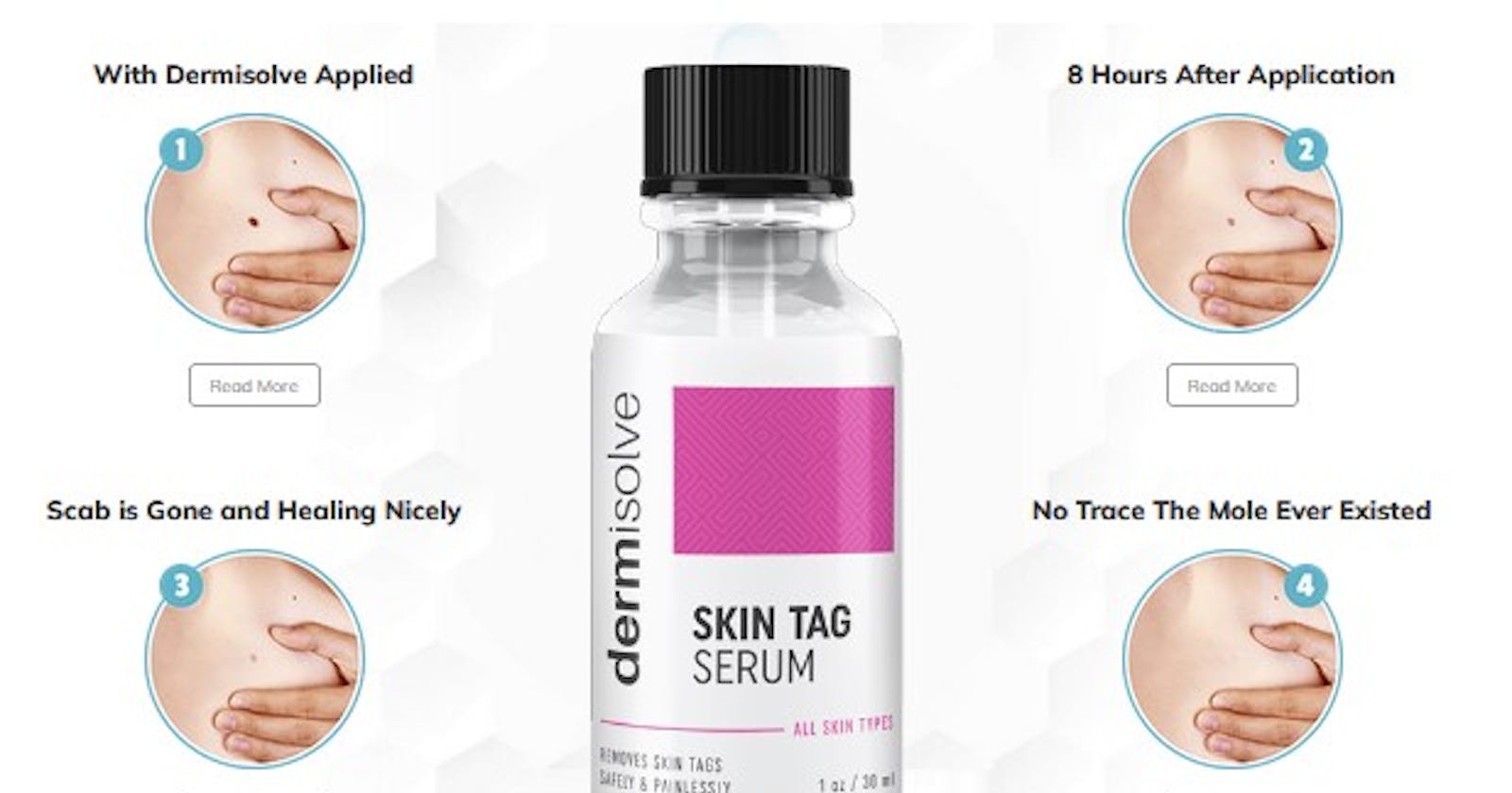Dermisolve Skin Tag Remover Reviews Don’t Take Before Know This Is It Really Effective 2023?