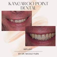 General Dentistry Kangaroo Point