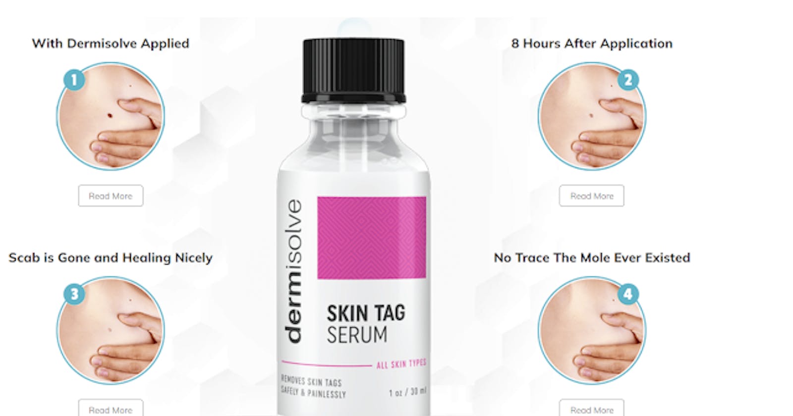 Dermisolve Skin Tag Remover Reviews Fraud Scam Exposed! It Is Safe Or Not!