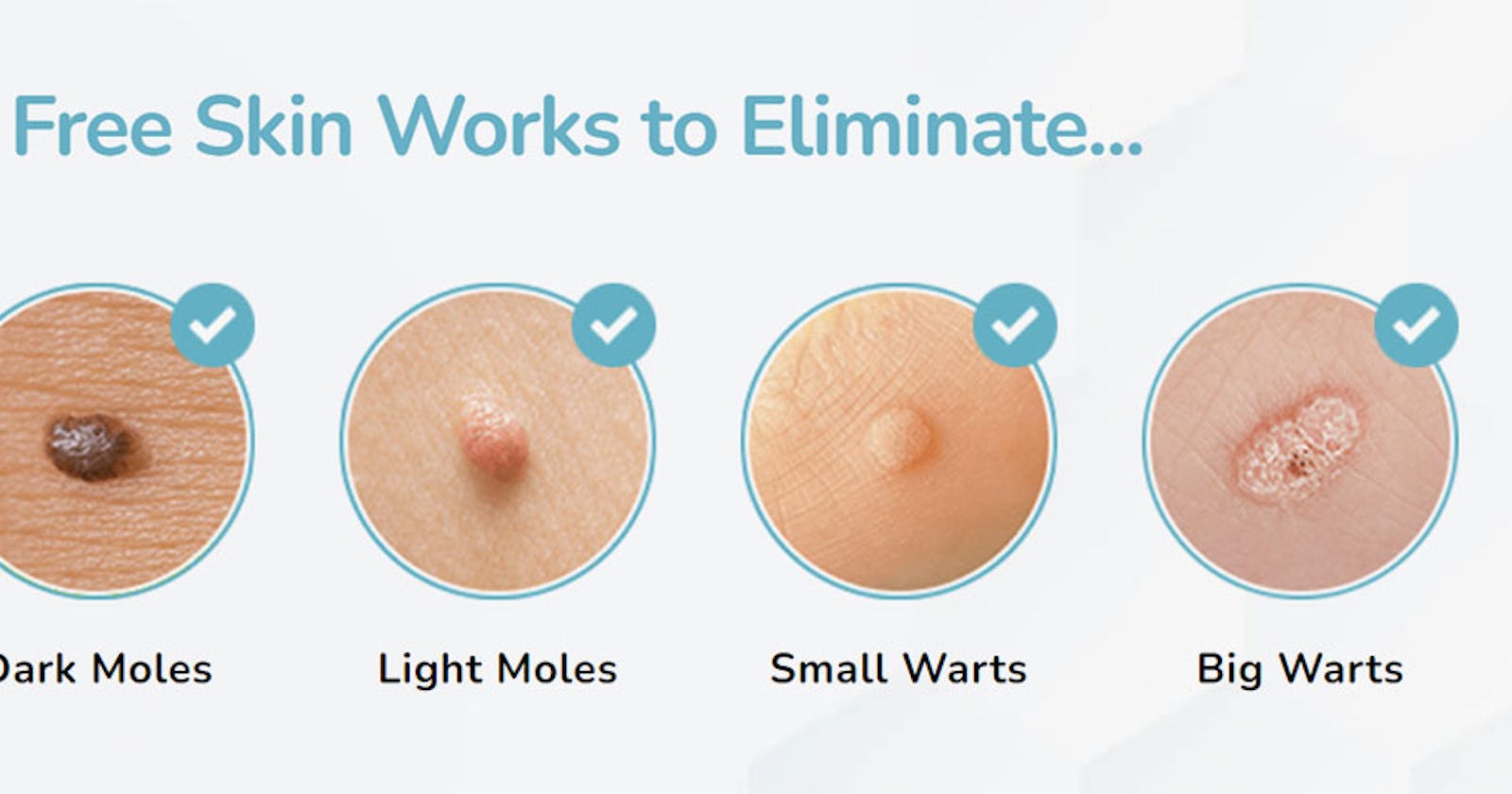 Anus Skin Tag Removal Cream Reviews Fraud Risks Exposed! Must Watch?