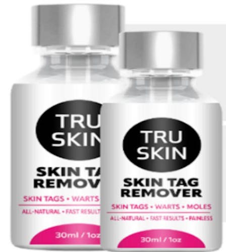 Tru Skin Tag Remover's blog