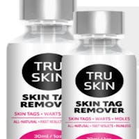 Tru Skin Tag Remover's photo