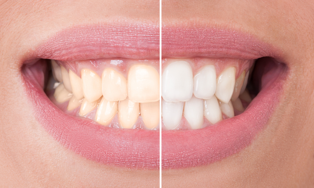 Wattle Grove Dental: Your Trusted Partner for Healthy Smiles