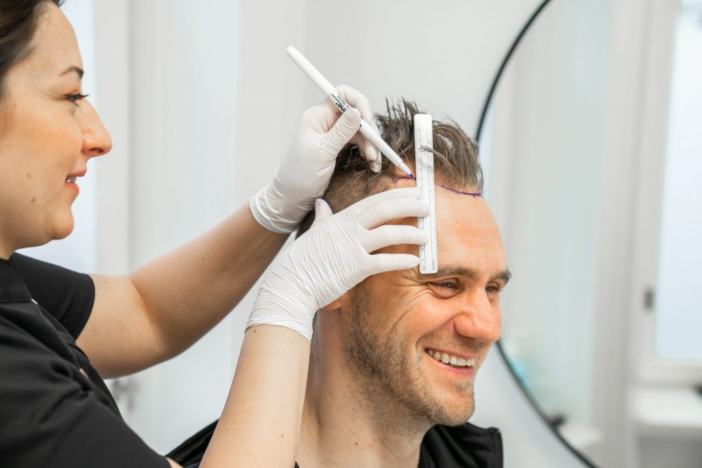 Confidence Redefined: Male Hair Transplants in Dubai