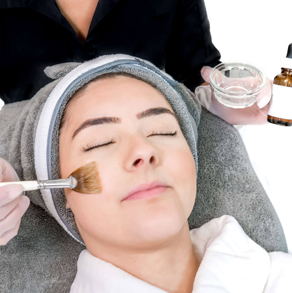 Skin Snap: The Speedy Magic of Peels