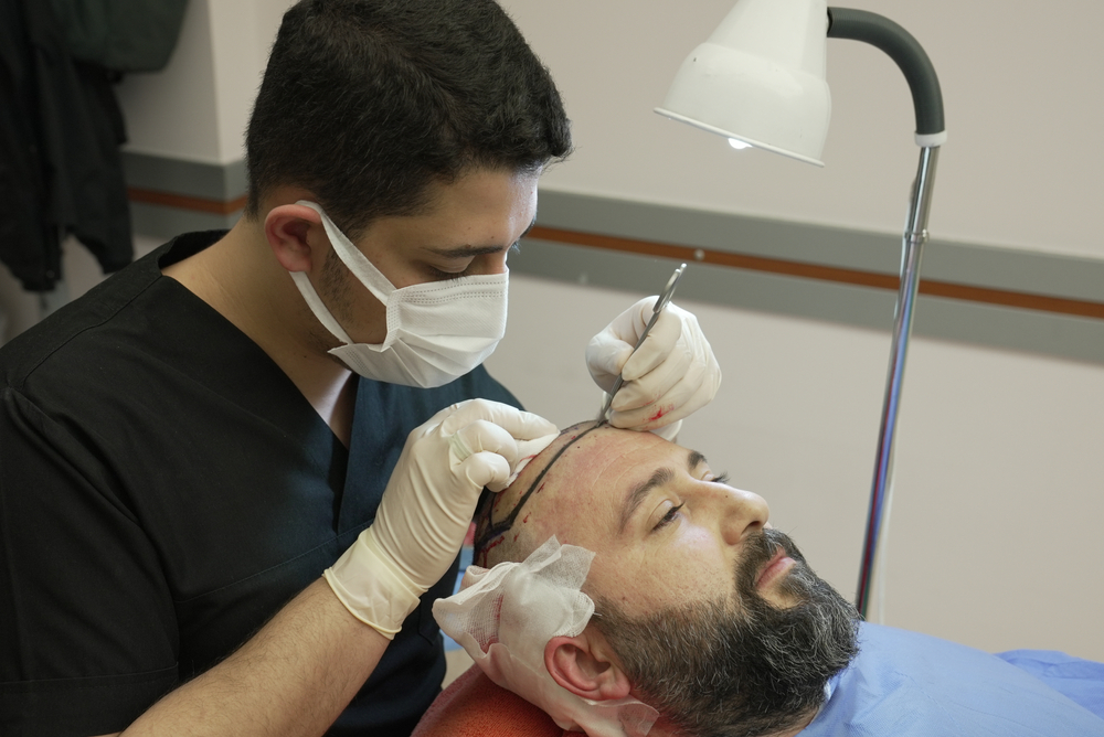 Religious Roots: Can You Get a Hair Transplant and Stay Halal?