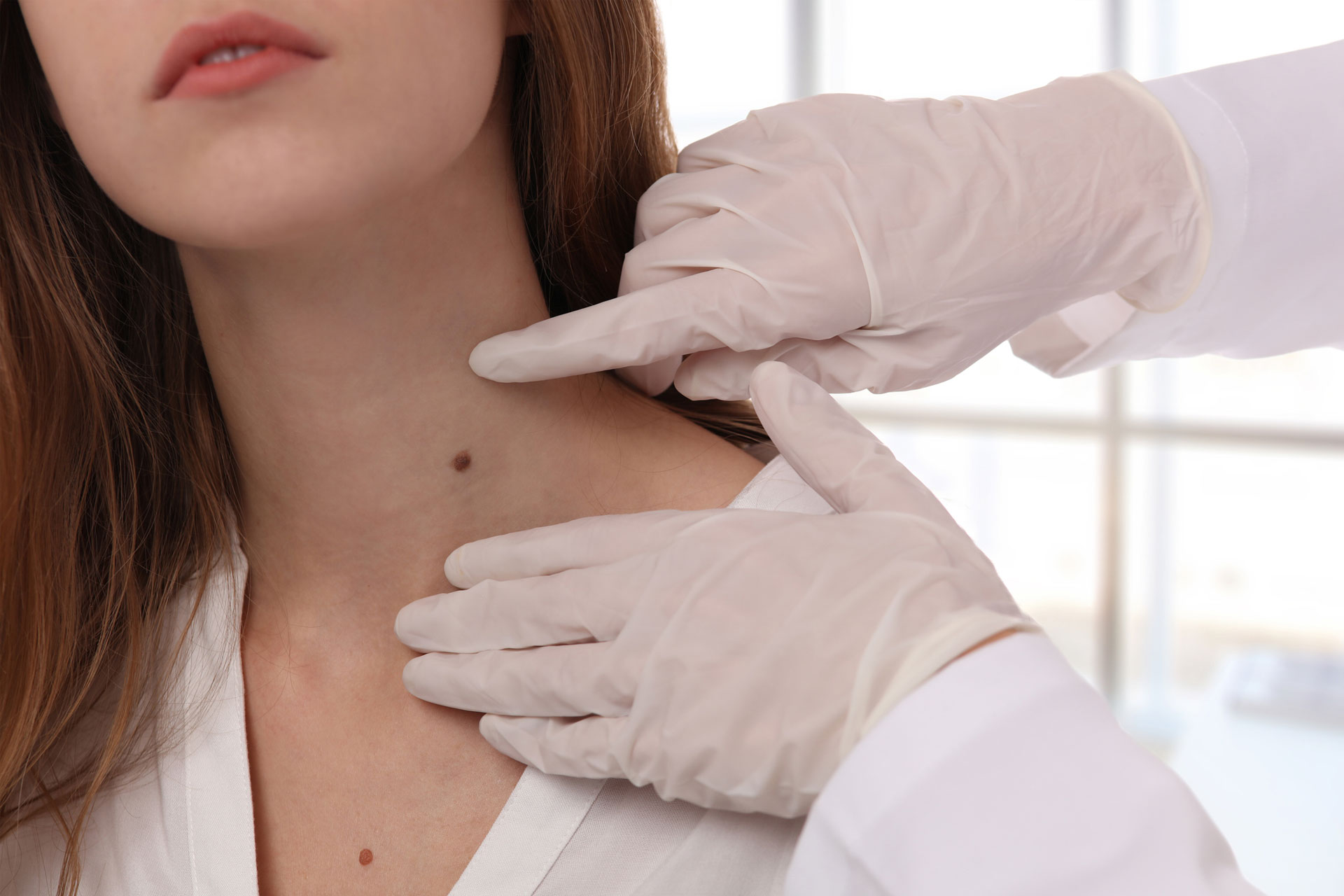 Warts Treatment by Top Skin Specialists at Institute Cosmetique in Lahore