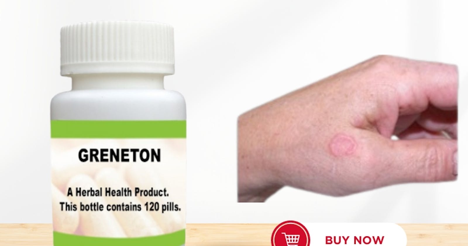 Get Relief from Granuloma Annulare with Natural Solutions