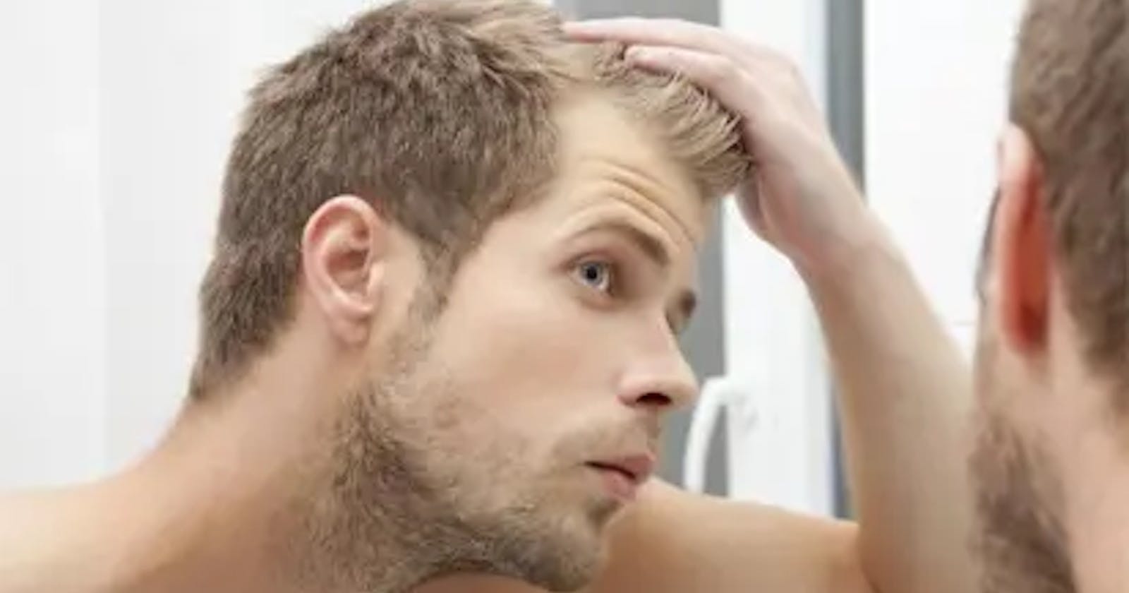 What Every Man Should Know About Normal Hairlines in Men