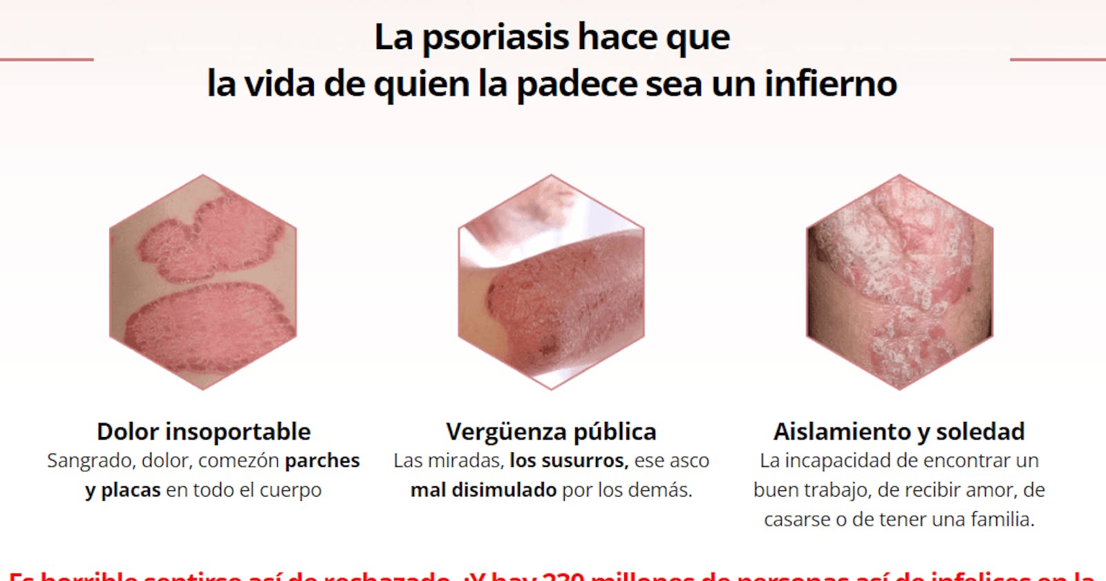 Sorax Crema Precio en Perú
