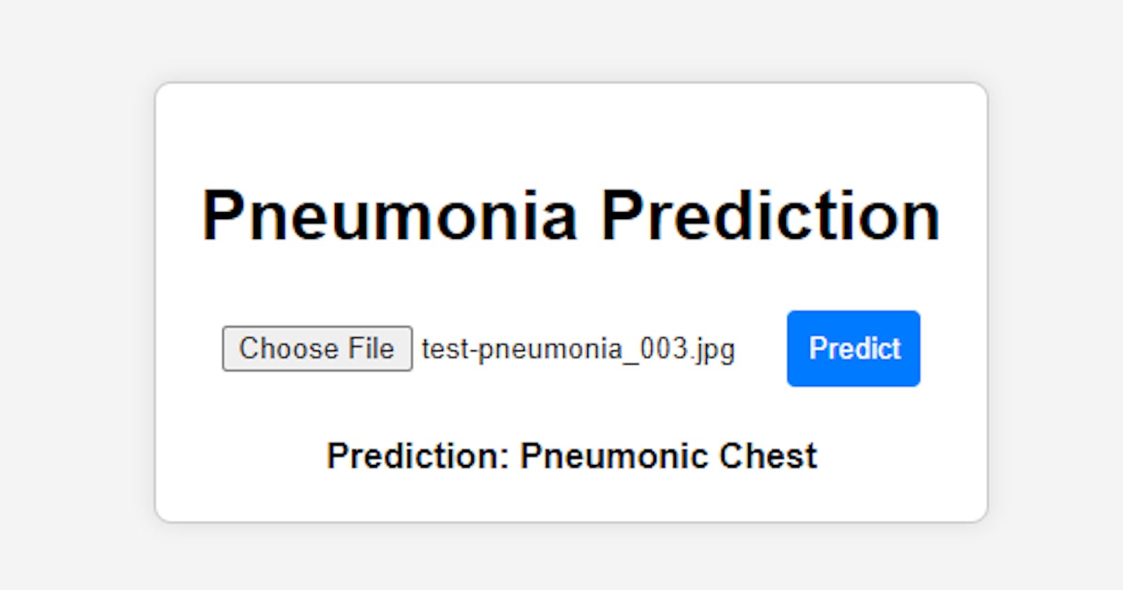 Predicting Pneumonia from Chest X-rays using Deep Learning, Computer Vision, and Flask
