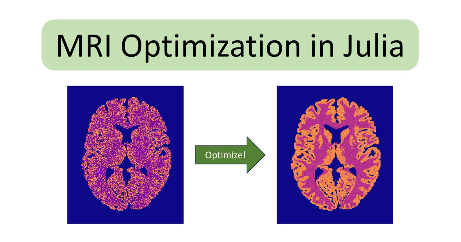 Efficient Julia Optimization through an MRI Case Study