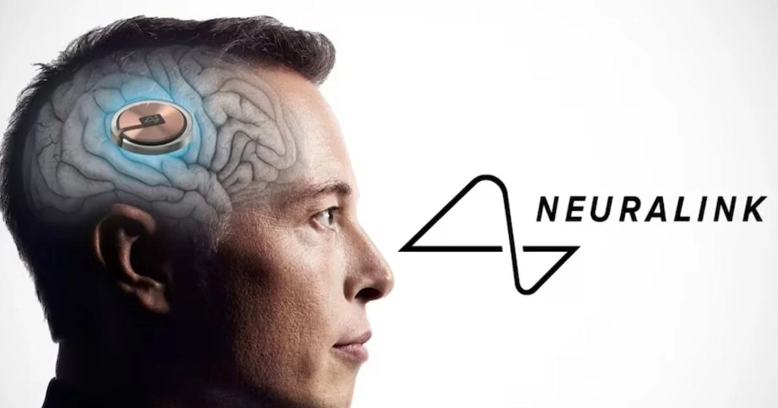 Elon Musk's Mind-Blowing 🤯Venture: Neuralink's Successful Brain Chip Implantation🧠