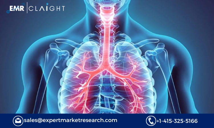 A Comprehensive Analysis of the Acute Respiratory Syndrome Treatment Market 2024-2032