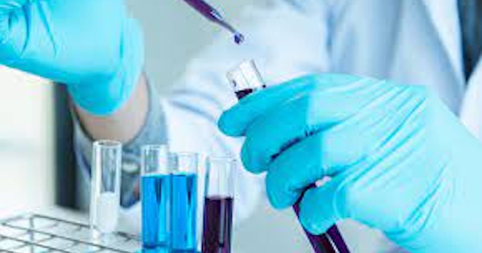 In Vitro Diagnostics Market Size, Share, Latest Trends, Analysis and Forecast 2024-2032