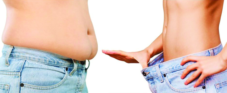 Dollars and Dirhams: Liposuction Costs Explained for Dubai Residents