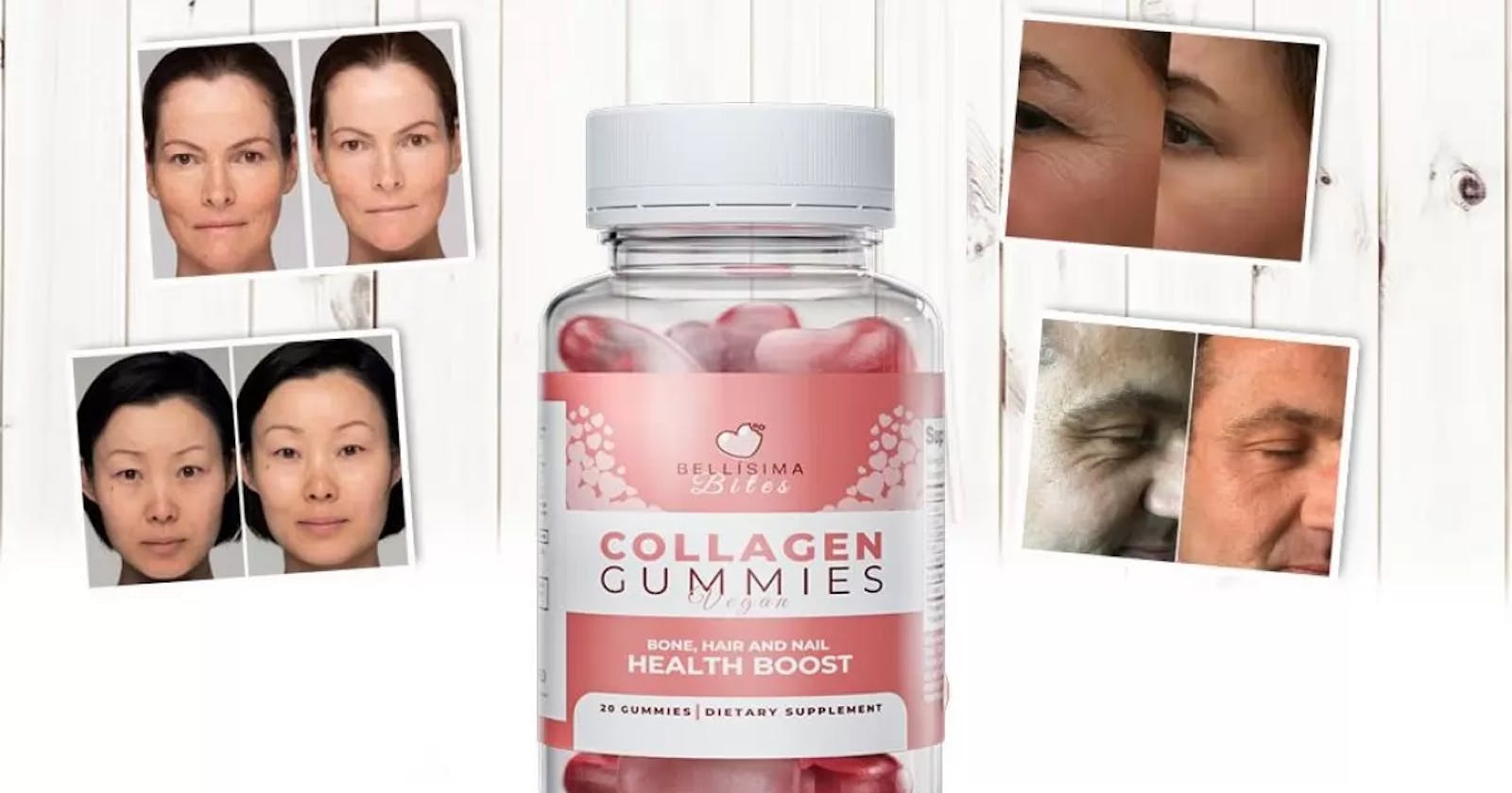 Bellissima Skin Anti Aging Gummies Result | Bellísima Skin Collagen Gummies USA Official Site