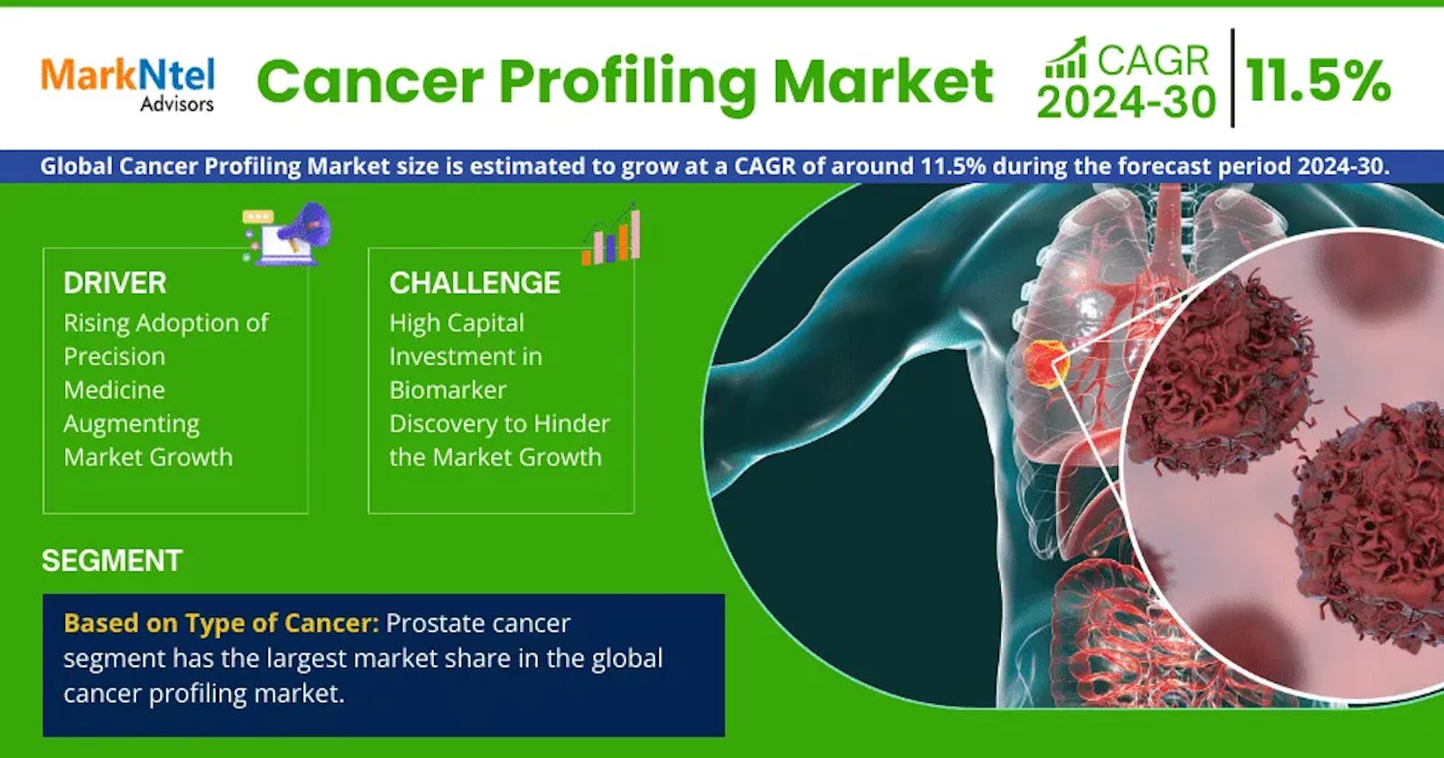 Cancer Profiling Market Anticipates Robust 11.5% CAGR for 2024-30