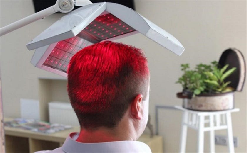 Image of a man undergoing laser therapy for hair growth.