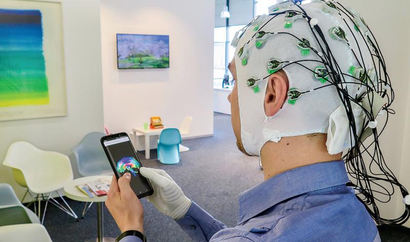 Navigating the Global Neuroprosthetics Frontier: Market Insights and Trends