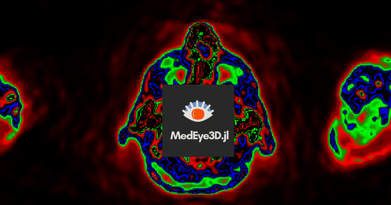 Documenting MedEye3d.jl iterations under Google-Summer-of-Code-2024