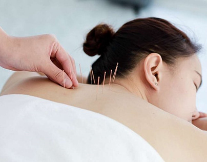 Neck Physio Adelaide